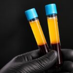 PRGF en odontología: qué es, beneficios y cómo ayuda a la regeneración de los tejidos